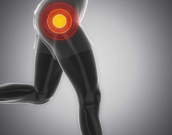 Orthopedics-Hip-Joint-Pain-Relief